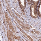 Immunohistochemical staining of human prostate shows moderate cytoplasmic positivity in smooth muscle and glandular cells.