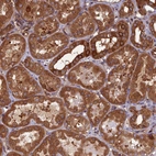 Immunohistochemical staining of human kidney shows strong cytoplasmic positivity in cells in tubules.