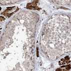 Anti-CARD6 Antibody