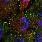 Immunofluorescent staining of human cell line U-251 MG shows localization to cytosol & focal adhesion sites.