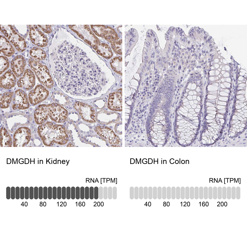 Anti-DMGDH Antibody
