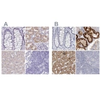 Immunohistochemical staining of human colon, kidney, liver and lymph node using Anti-DMGDH antibody HPA036442 (A) shows similar protein distribution across tissues to independent antibody HPA036441 (B).