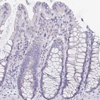Immunohistochemical staining of human colon shows low expression as expected.
