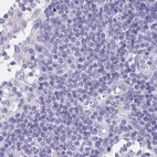 Immunohistochemical staining of human lymph node using Anti-DMGDH antibody HPA036442.