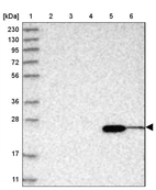 Lane 1: Marker [kDa] 230, 130, 95, 72, 56, 36, 28, 17, 11_br/_Lane 2: Human cell line RT-4_br/_Lane 3: Human cell line U-251MG sp_br/_Lane 4: Human plasma (IgG/HSA depleted)_br/_Lane 5: Human liver tissue_br/_Lane 6: Human tonsil tissue
