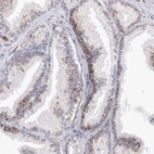 Immunohistochemical staining of human Prostate shows moderate granular cytoplasmic positivity in glandular cells.