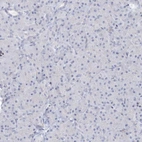 Immunohistochemical staining of human Pancreas shows very weak granular cytoplasmic positivity in exocrine glandular cells.