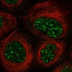 Immunofluorescent staining of human cell line A-431 shows localization to nucleoplasm & nuclear bodies.