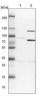 Lane 1: NIH-3T3 cell lysate (Mouse embryonic fibroblast cells)_br/_Lane 2: NBT-II cell lysate (Rat Wistar bladder tumour cells)