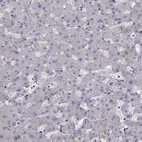 Immunohistochemical staining of human liver shows low expression as expected.