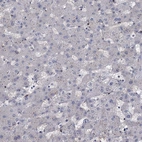 Immunohistochemical staining of human liver shows low expression as expected.