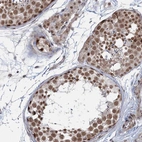 Immunohistochemical staining of human testis shows high expression.