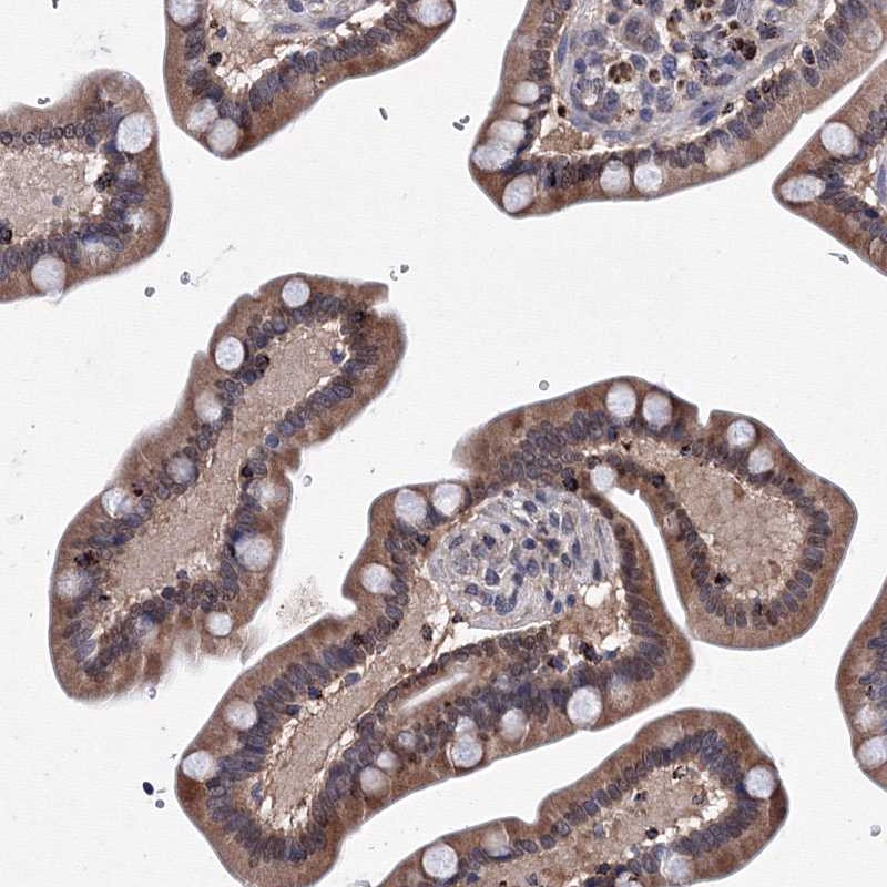 Anti-PHYKPL Antibody