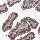 Anti-PHYKPL Antibody