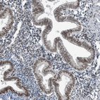 Anti-YTHDC1 Antibody