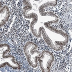 Anti-YTHDC1 Antibody