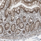 Immunohistochemical staining of human duodenum shows moderate nuclear positivity in glandular cells.