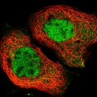 Immunofluorescent staining of human cell line A-431 shows localization to nucleoplasm.