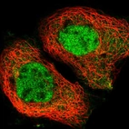 Immunofluorescent staining of human cell line A-431 shows localization to nucleoplasm.