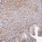 Anti-SH3PXD2B Antibody