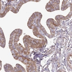 Immunohistochemical staining of human Fallopian tube shows moderate cytoplasmic positivity in glandular cells.