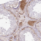 Immunohistochemical staining of human testis shows strong cytoplasmic positivity in Leydig cells.