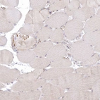 Immunohistochemical staining of human skeletal muscle shows low expression in myocytes as expected.