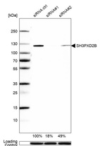 Western blot analysis in U2OS cells transfected with control siRNA, target specific siRNA probe #1 and #2, using Anti-SH3PXD2B antibody. Remaining relative intensity is presented. Loading control: Anti-GAPDH.