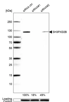 Western blot analysis in U2OS cells transfected with control siRNA, target specific siRNA probe #1 and #2, using Anti-SH3PXD2B antibody. Remaining relative intensity is presented. Loading control: Anti-GAPDH.