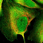Immunofluorescent staining of human cell line U-2 OS shows localization to nucleus & plasma membrane.