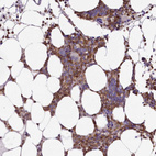 Immunohistochemical staining of human bone marrow shows moderate cytoplasmic positivity in hematopoietic cells.