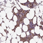 Immunohistochemical staining of human bone marrow shows moderate cytoplasmic positivity in hematopoietic cells.