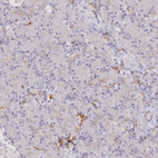 Immunohistochemical staining of human pancreas shows no positivity in exocrine glandular cells as expected.