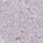 Immunohistochemical staining of human pancreas shows no positivity in exocrine glandular cells as expected.