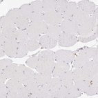 Immunohistochemical staining of human skeletal muscle shows no positivity in myocytes as expected.