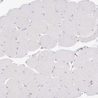 Immunohistochemical staining of human skeletal muscle shows no positivity in myocytes as expected.