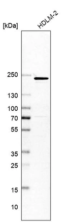 Western blot analysis in human cell line HDLM-2.