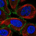 Immunofluorescent staining of human cell line PC-3 shows localization to plasma membrane.