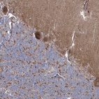 Anti-ARSJ Antibody