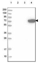 Lane 1: Marker [kDa] 250, 130, 95, 72, 55, 36, 28, 17, 10_br/_Lane 2: Human cell line RT-4_br/_Lane 3: Human cell line U-251 MG_br/_Lane 4: Human plasma