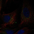 Immunofluorescent staining of human cell line BJ shows localization to vesicles.