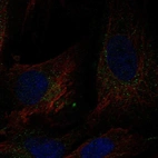 Immunofluorescent staining of human cell line BJ shows localization to vesicles.