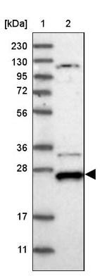 Lane 1: Marker [kDa] 230, 130, 95, 72, 56, 36, 28, 17, 11_br/_Lane 2: Human cell line RT-4