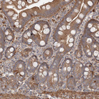 Anti-DHRS9 Antibody