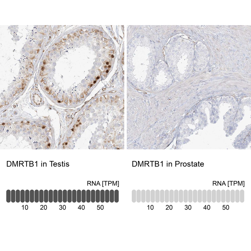 Anti-DMRTB1 Antibody