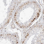 Immunohistochemical staining of human testis shows high expression.