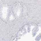 Immunohistochemical staining of human prostate shows low expression as expected.