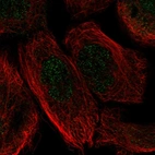 Immunofluorescent staining of human cell line A-431 shows localization to nucleoplasm.