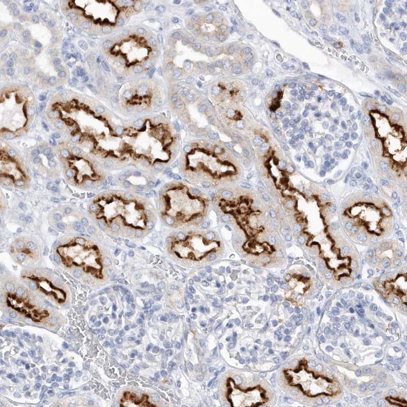 Anti-RPE Antibody