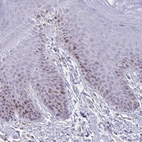 Immunohistochemical staining of human skin shows weak to moderate nuclear positivity in a subset of squamous epithelial cells.